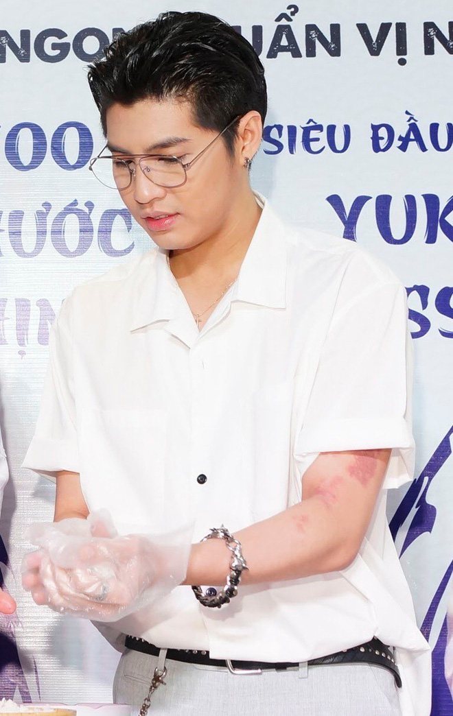 dien do trang banh bao noo phuoc thinh xuat hien sau su co bi go mv