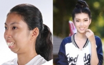 buon vi ca doi bi che xau co gai di phau thuat tham my ve xinh nhu mong khien ai cung xuyt xoa khen ngoi