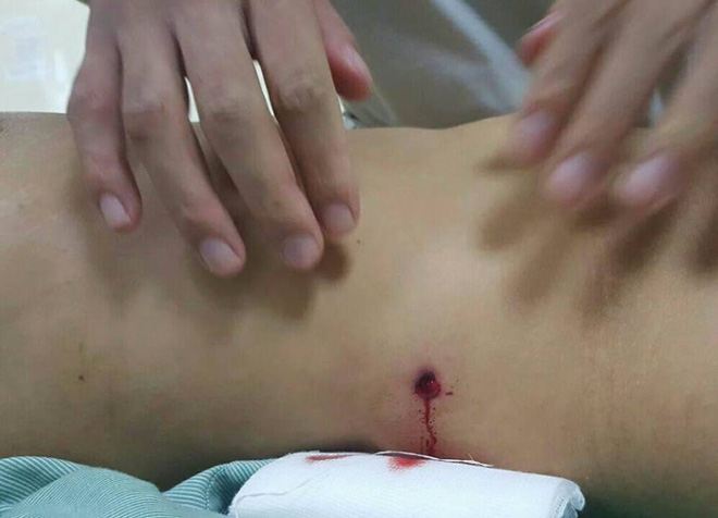vu hai nhom no sung hon chien khien co gai thung dai trang tai ha noi cong an trieu tap mot so doi tuong