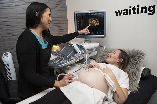 khao khat co them con me kha soc nghe bac si bao phai sinh som 10 tuan chi vi thai ki qua hiem