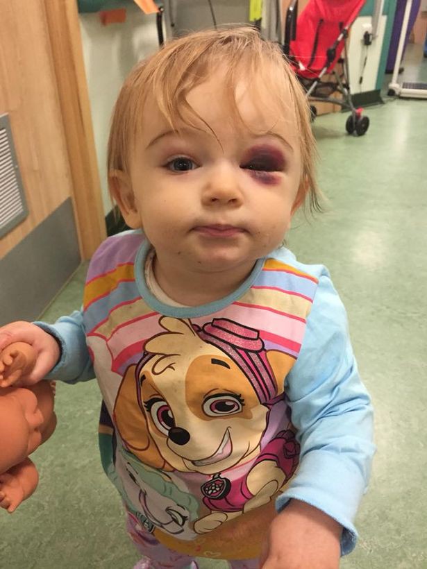 be gai vo xuong so vi sat thu tham lang trong nha ma it bo me nao de y den