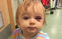 be gai vo xuong so vi sat thu tham lang trong nha ma it bo me nao de y den