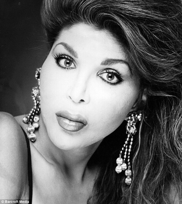 nghien phau thuat tham my co the my nhan chuyen gioi bien dang sau hon 200 lan tiem silicon