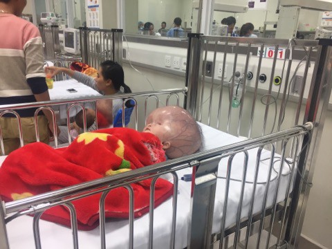 sau thoi gian chong choi voi benh tat be trai bi nao ung thuy o thanh hoa da qua doi