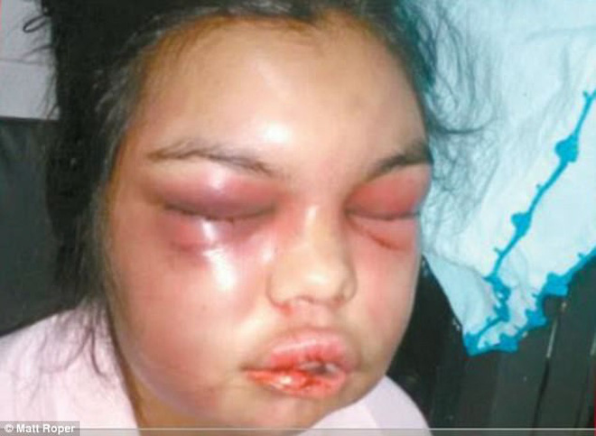 nguoi phu nu bi chong dam moi khi co ai do like anh cua co tren facebook