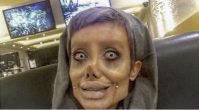 co gai phau thuat tham my hon 50 lan de nhin giong angelina jolie ket qua tra ve gia tinh dobby