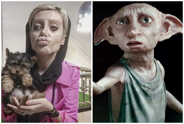 co gai phau thuat tham my hon 50 lan de nhin giong angelina jolie ket qua tra ve gia tinh dobby