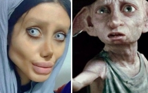 co gai phau thuat tham my hon 50 lan de nhin giong angelina jolie ket qua tra ve gia tinh dobby