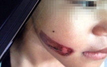 cong an thuc nghiem hien truong vu be gai nghi bi gi sat nong vao nguoi