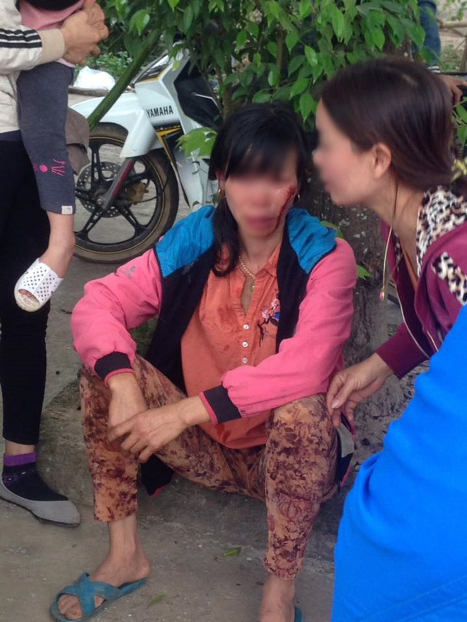 xon xao clip bat gap chong di cung nhan tinh ngay giua cho vo bi chong giu lai cho bo danh bi thuong