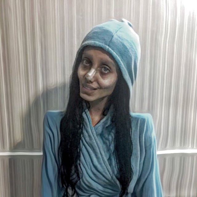 19 tuoi co ay phau thuat tham my 50 lan de giong angelina jolie 10 nam sau dung nhan hau phau khien nguoi ta chet dung