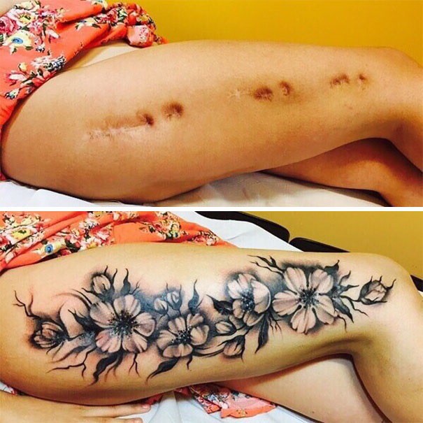 man thoat xac ngoan muc cua nhung vet seo xau xi thanh 16 hinh xam doc dao