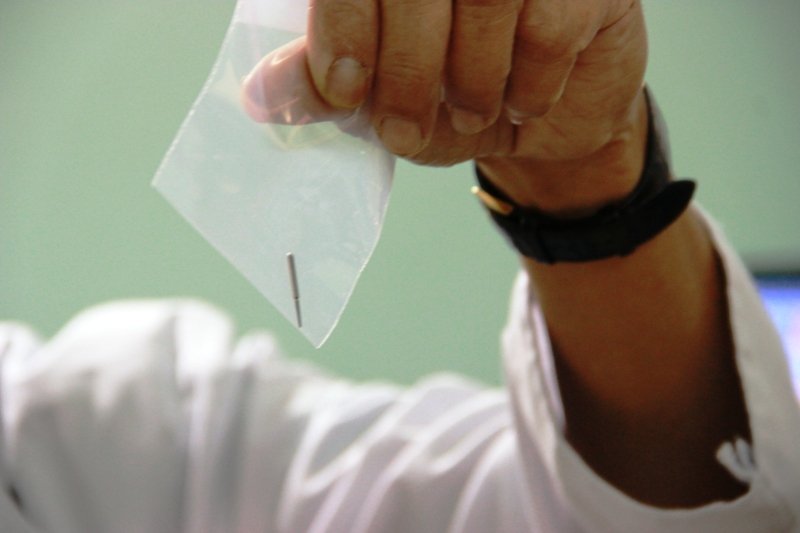 dung cu nha khoa that lac trong bung benh nhan