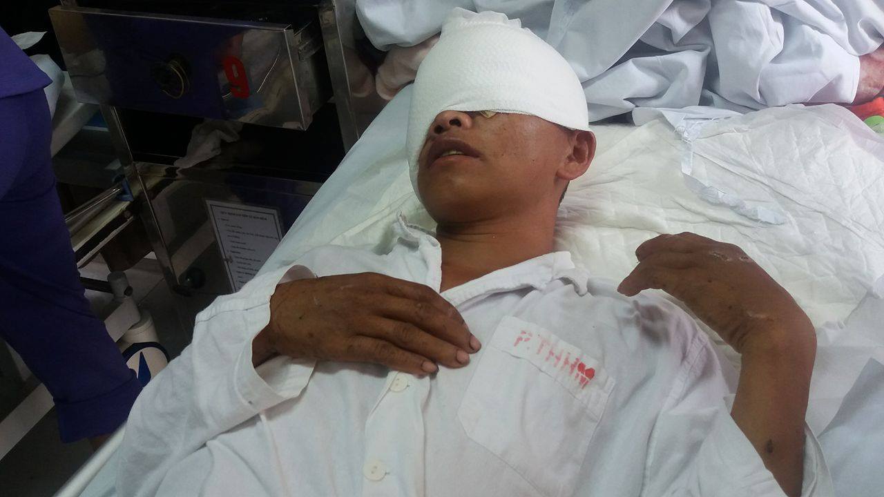 nguoi dan ong dan toc mong bi gau tan cong hong 2 mat