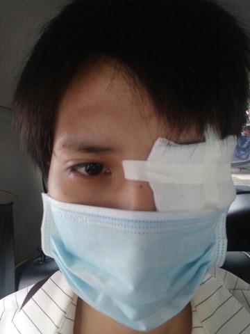 nu nguoi mau cao nhat viet nam nhap vien vi mat thi luc