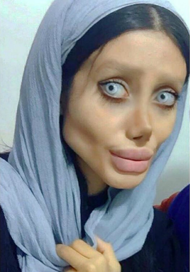 truoc khi phau thuat tham my 50 lan co gai co guong mat giong angelina jolie da tung xinh dep nhu the nay