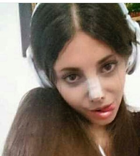 truoc khi phau thuat tham my 50 lan co gai co guong mat giong angelina jolie da tung xinh dep nhu the nay