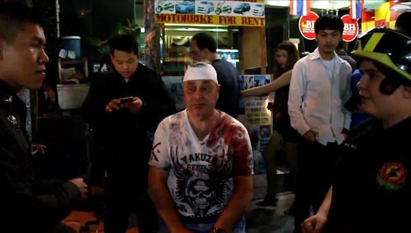 du khach bi nguoi ban xu danh chay mau dau vi gop y ve viec de xe tren via he