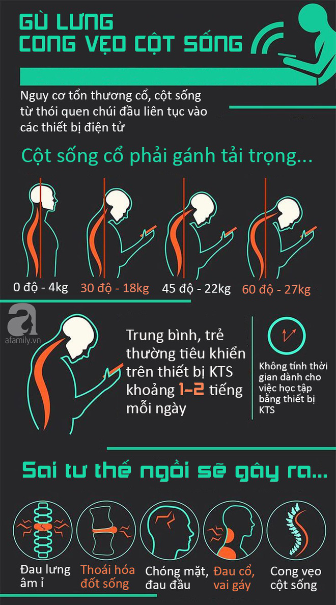 canh bao tre som bi gu lung cong veo cot song chi tu mot thoi quen tuong chung nhu vo hai nay