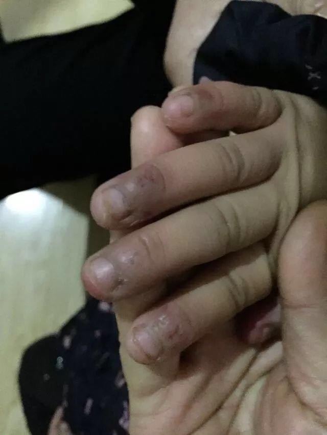 be gai 6 tuoi bi me de nguoc dai da man khien mat day vet thuong toc rung thanh mang lon