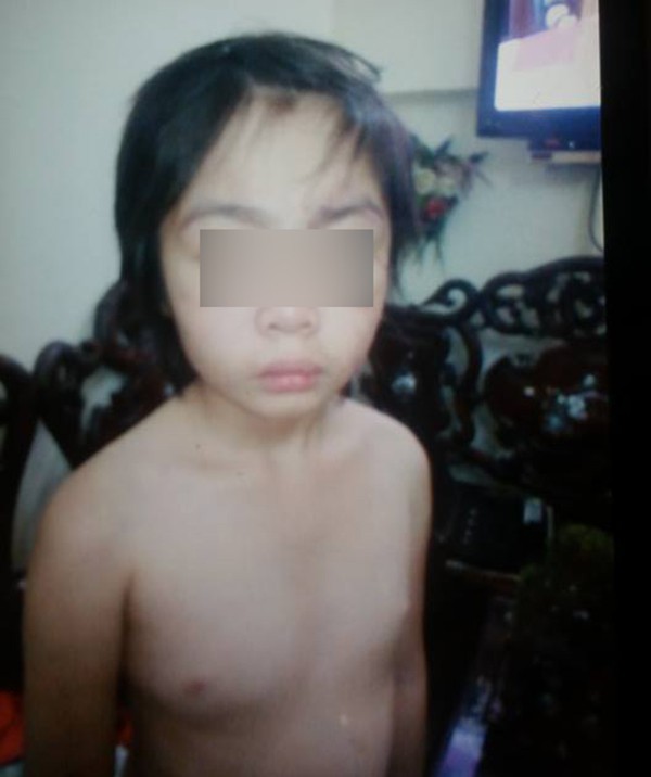 ha noi tam giu hinh su nguoi cha danh dap hanh hung con trai 10 tuoi gay xuong suon ran so nao