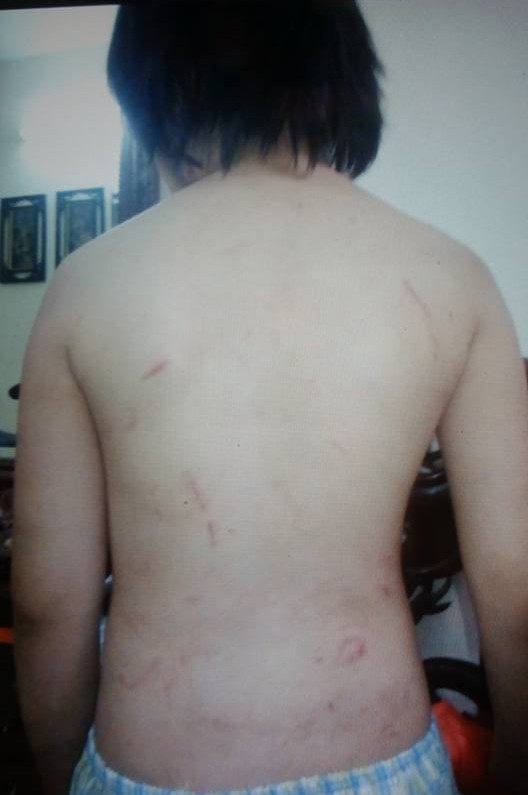 ha noi tam giu hinh su nguoi cha danh dap hanh hung con trai 10 tuoi gay xuong suon ran so nao
