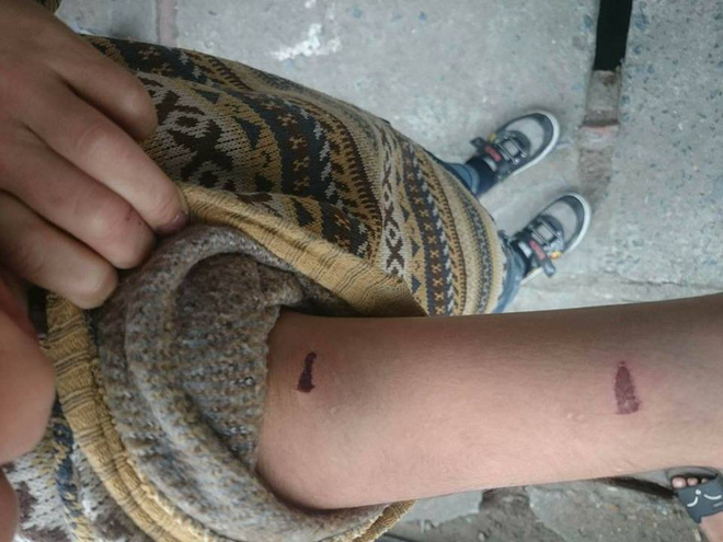 ha noi bo ruot dung day dien danh dap con trai 9 tuoi da man me dau don cau cuu cong an