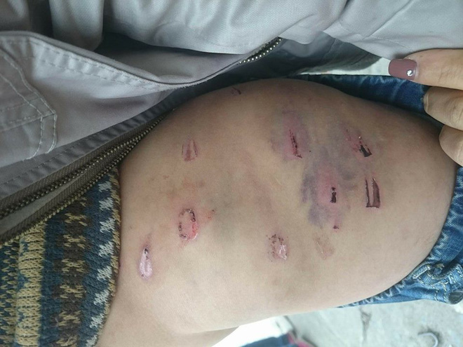 ha noi bo ruot dung day dien danh dap con trai 9 tuoi da man me dau don cau cuu cong an