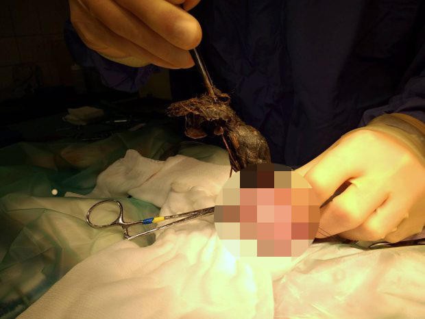 thay bung meo to khac thuong gia dinh tuong sap de nhung khi mo ra thi su that khong phai nhu vay