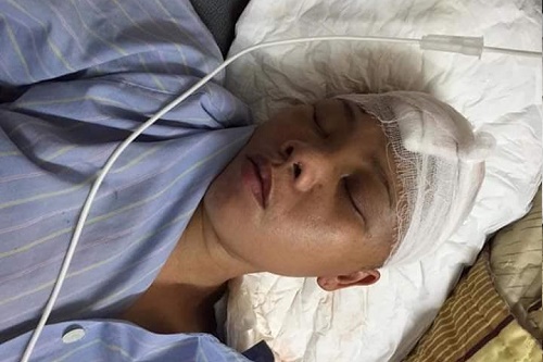 nghe an tuong lai mit mu cua 2 dua tre me nguy kich vi tai nan