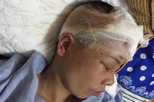 nghe an tuong lai mit mu cua 2 dua tre me nguy kich vi tai nan