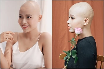 Nữ sinh mắc ung thư khi 20 tuổi: ‘Đau đớn cũng là một dạng trải nghiệm’